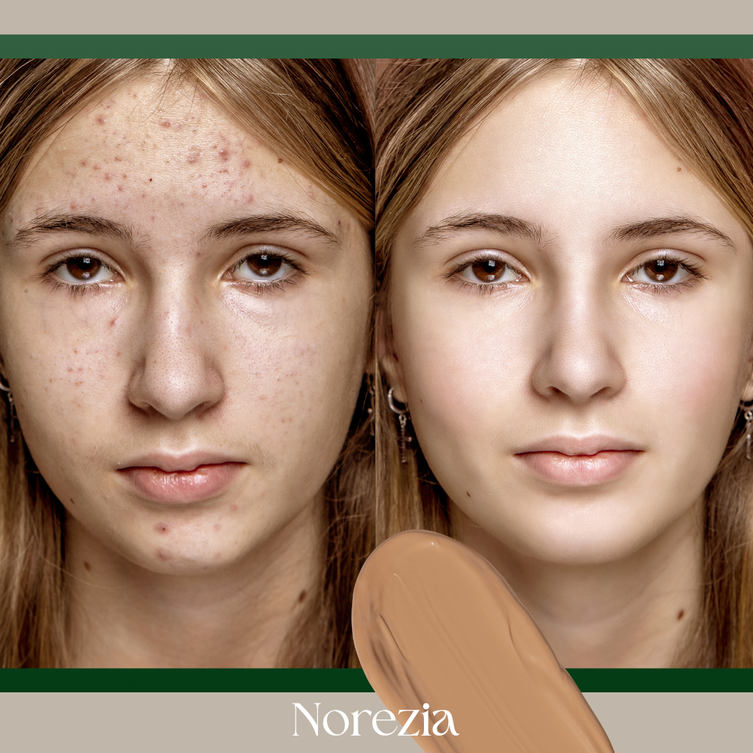CC Cream ™ Norezia. Dile Adiós al Acné y a las Arrugas 1+1 GRATIS
